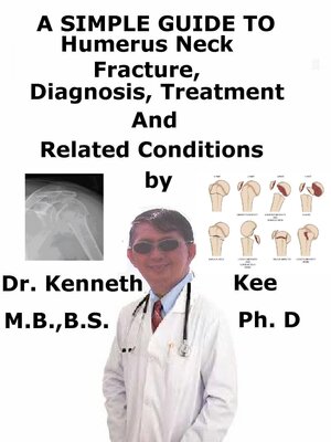 cover image of A Simple Guide to Humerus Neck Fracture, (As narrated by a Patient), Diagnosis, Treatment and Related Conditions